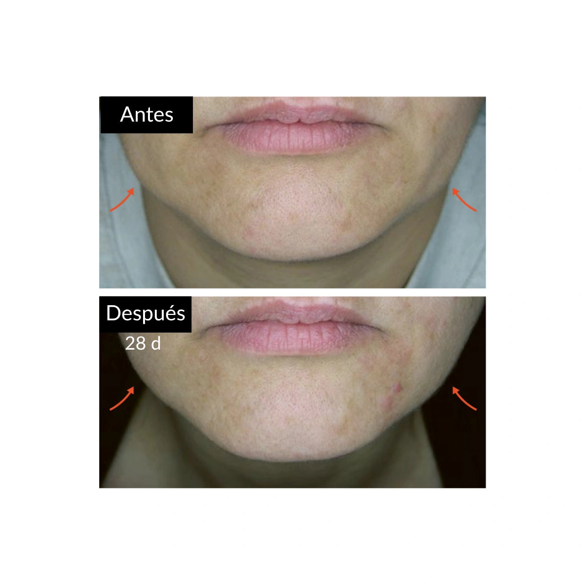 cosmeticos con exosomas Kosei exosomes-FS