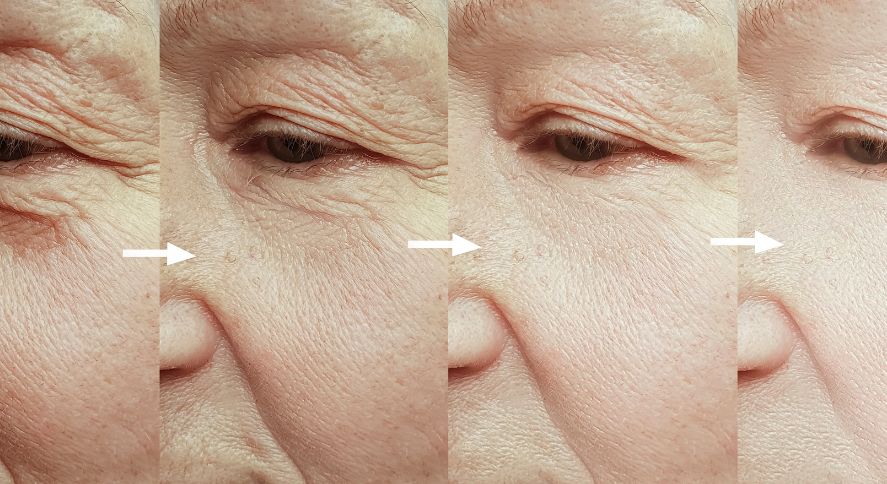 Rutina Facial Antiarrugas