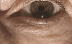 Trucos para bolsas y  ojeras ¿Tu mirada te delata?