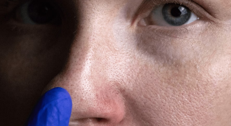 Rutina facial para piel grasa