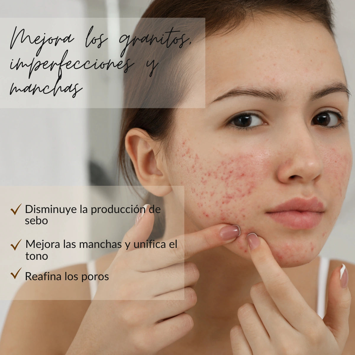 acido azelaico serum kosei azelac-sa