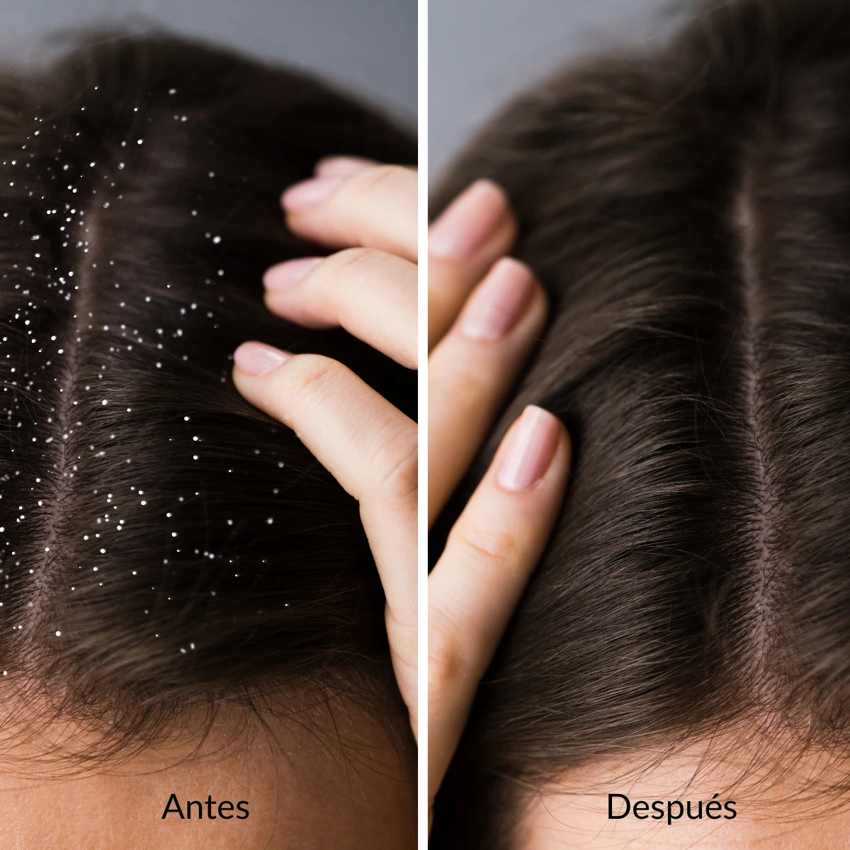 PDRN-HA Serum Facial Antiarrugas