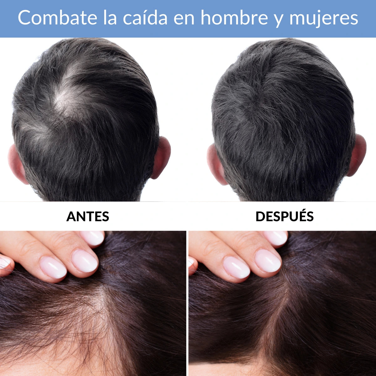 vitaminas para el cabello kosei tricoxil capsulas